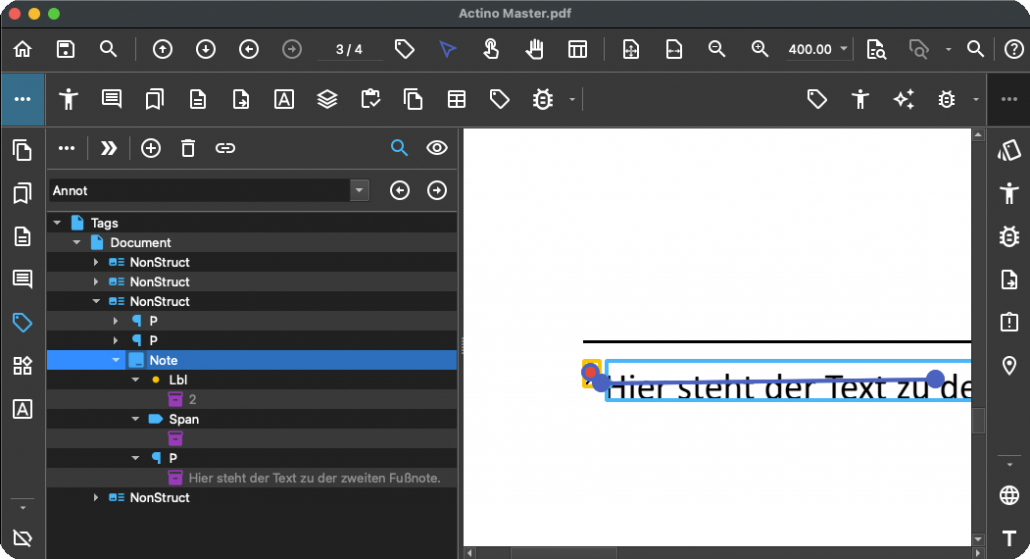 PAC Quality Note Lbl Fix